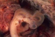 對人類大腦發(fā)育的獨特見解：早期胚胎大腦的模型