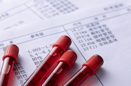 西瓜簡(jiǎn)筆畫的畫法3