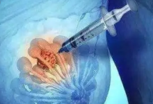 全球主要研究揭示了乳腺癌擴散到身體其他部位的風險