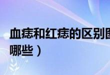 血痣和紅痣的區(qū)別圖片（血痣和紅痣的區(qū)別有哪些）