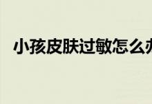 小孩皮膚過敏怎么辦（要重視這四個(gè)方面）