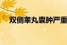 雙側睪丸囊腫嚴重嗎（睪丸囊腫嚴重嗎）
