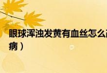 眼球渾濁發(fā)黃有血絲怎么改善（眼球渾濁發(fā)黃有血絲是什么?。?class=
