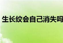 生長(zhǎng)紋會(huì)自己消失嗎（生長(zhǎng)紋會(huì)自己消除嗎）