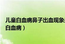 兒童白血病鼻子出血現(xiàn)象是怎樣的（寶寶鼻子出血是不是是白血?。?class=