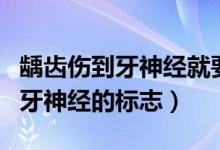 齲齒傷到牙神經(jīng)就要做根管治療嗎（齲齒傷到牙神經(jīng)的標志）