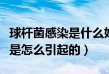 球桿菌感染是什么婦科?。▼D科球菌桿菌感染是怎么引起的）