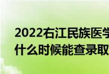 2022右江民族醫(yī)學(xué)院錄取時間及查詢?nèi)肟冢ㄊ裁磿r候能查錄?。?class=