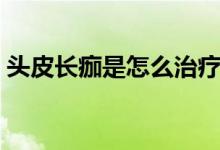 頭皮長(zhǎng)痂是怎么治療（頭皮結(jié)痂該怎么治療）