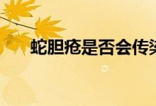 蛇膽瘡是否會(huì)傳染（蛇膽瘡會(huì)傳染嗎）