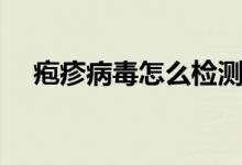 皰疹病毒怎么檢測(cè)（皰疹病毒怎么根治）