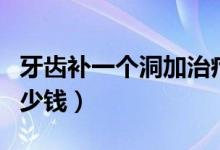 牙齒補一個洞加治療多少錢(牙齒補一個洞多少錢)